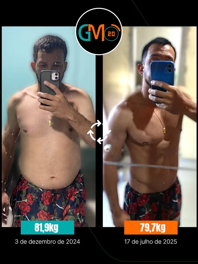 antes e depois gm20