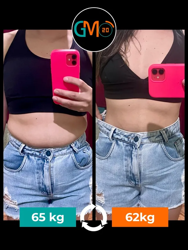 antes e depois gm20
