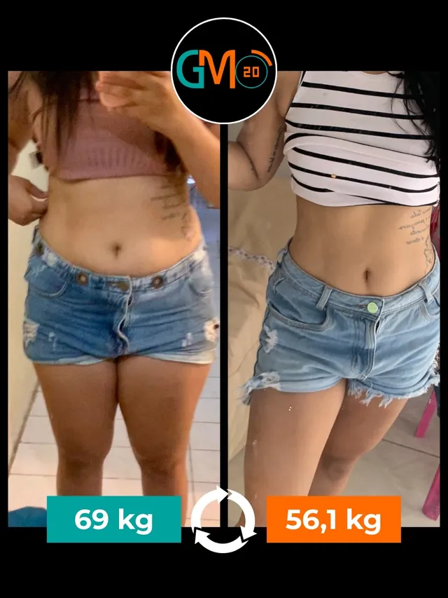 antes e depois gm20