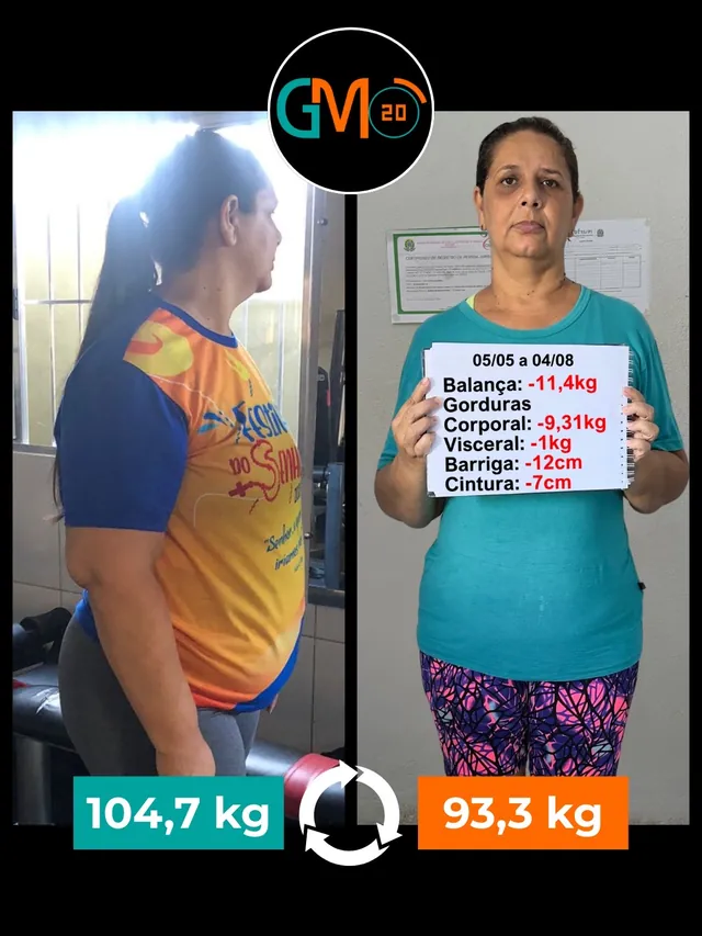 antes e depois gm20